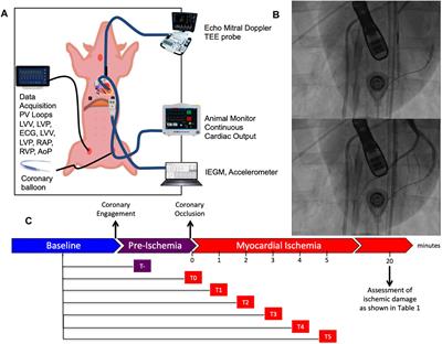 Reintroducing Heart Sounds for Early Detection of Acute Myocardial Ischemia in a Porcine Model – Correlation of Acoustic Cardiography With Gold Standard of Pressure-Volume Analysis